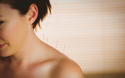 What Should You Expect During Your First Facial Acupuncture Session?