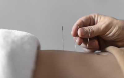 Unraveling the Truth: Acupuncture Myths Explained